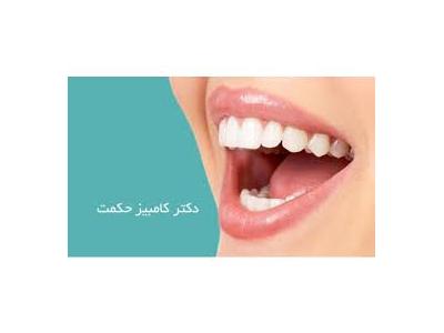 بهترین متخصص دندانپزشکی در قیطریه-دکتر کامبیز حکمت جراح و دندانپزشک ، درمان ایمپلنت ، ایمپلنتولوژیست در تهران 