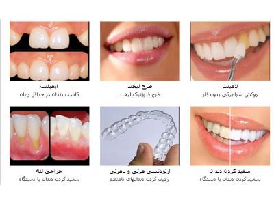 کاشت دندان-متخصص ارتودنسی و ایمپلنت در اسلامشهر