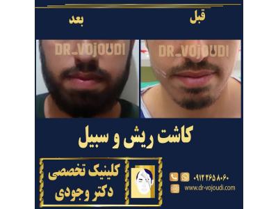 جوانسازی صورت و پوست به روش PRP و مزوتراپی-کلینیک تخصصی پوست و مو دکتر وجودی 