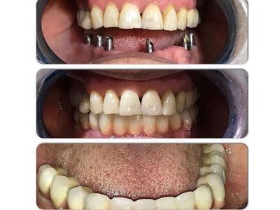 جراح دهان و دندان-جراحی زیبایی بینی ، جراحی فک و ایمپلنت در تهران 