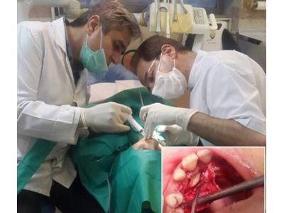 درمان ایمپلنت در تهران-بهترین مطب دندانپزشکی در سعادت آباد 