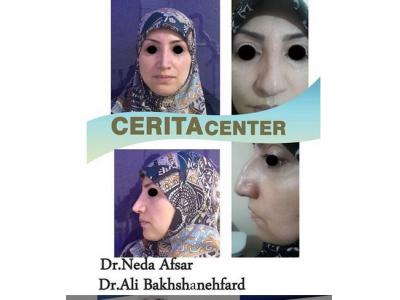 تهران-جراحی زیبایی بینی ، جراحی فک و ایمپلنت در تهران 
