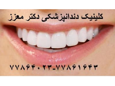 جراح و دندانپزشک-کلینیک دندانپزشکی دکتر محمدرضا معزز جراح ، دندانپزشک متخصص ایمپلنت در تهرانپارس