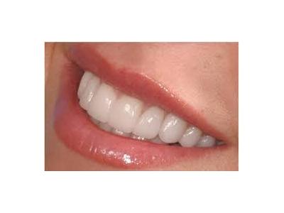 بهترین دندانپزشک محدوده جیحون-کلینیک تخصصی داندانپزشکی در محدوده  جیحون