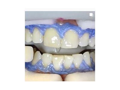 تجهیزات عمومی-کلینیک دندانپزشکی نکو 