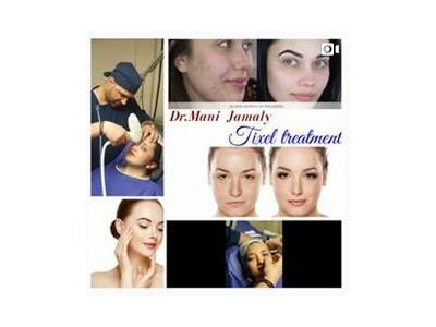 لیفت پشت پلک چشم-دکتر مانی جمالی متخصص پوست و مو   در نیاوران 