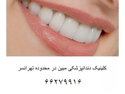 درمان ایمپلنت در تهران-افتتاح کلینیک دندانپزشکی مبین در محدوده تهرانسر 