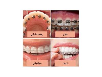 بهترین متخصص دندانپزشکی در تهران-کلینیک دندانپزشکی دکتر محمدرضا معزز جراح ، دندانپزشک متخصص ایمپلنت در تهرانپارس